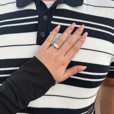 Hand with a diamond ring resting on a striped shirt
